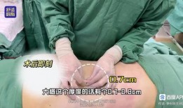 爆料桂哥抽脂视频,揭秘网红整形背后的真相